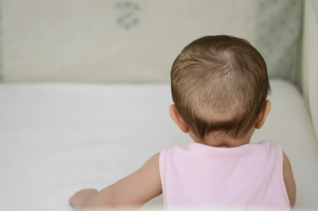 What Causes Hair Breakage in Babies?